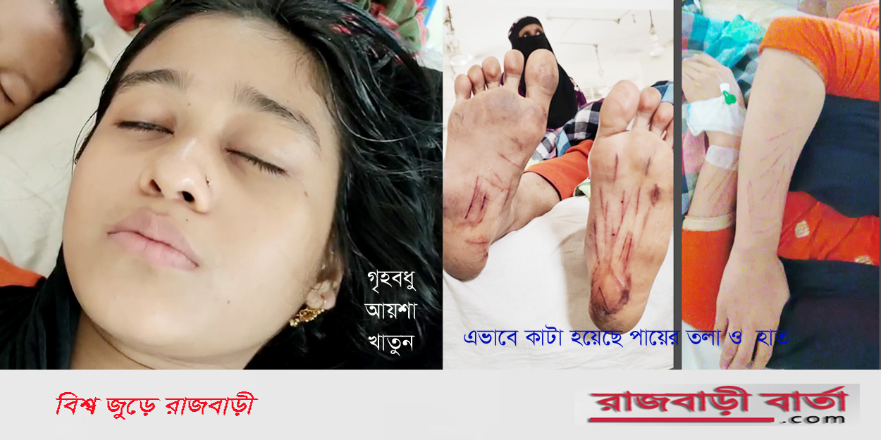 মামলা দায়েরেও বাঁধা : কালুখালীতে গৃহবধু’র হাত ও পায়ে ধারালো অস্ত্রের জখম | মামলা দায়েরেও বাঁধা : কালুখালীতে গৃহবধু’র হাত ও পায়ে ধারালো অস্ত্রের জখম |